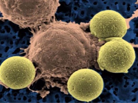 t-cells immune system cancer immunotherapy