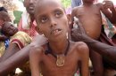 A malnourished and displaced Somali boy waits for food rations in Mogadishu