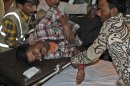 A Pakistani man, who was injured in a bomb blast, is brought to a hospital in Karachi, Pakistan, Sunday, March 3, 2013. Pakistani officials say a bomb blast has killed dozens of people in a neighborhood dominated by Shiite Muslims in the southern city of Karachi. (AP Photo/Shakil Adil)