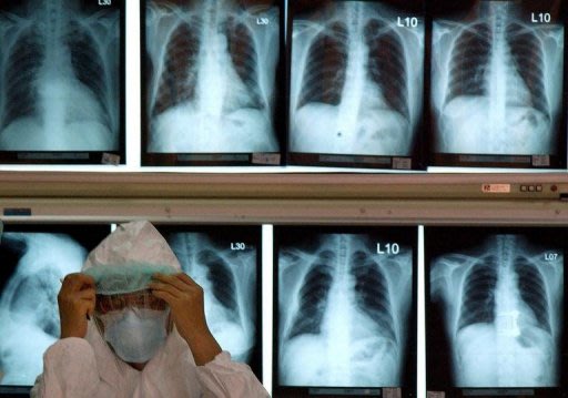 A medical staff adjusts his mask in front of patients' X-ray files at the entrance of the National Taiwan Universty Hospital in Taipei, 27 May 2003. A SARS-like virus that has struck in Britain and the Middle East has claimed a new victim in Saudi Arabia, bringing the global toll from the mystery illness to nine, the World Health Organisation said Tuesday