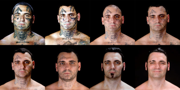 This combination of eight photos provided by Bill Brummel Productions shows the progress of tattoo removal treatments for former skinhead Bryon Widner. For 16 years, Widner was a glowering, swaggering, menacing vessel of savagery - an "enforcer" for some of America’s most notorious and violent racist skinhead groups. Though his beliefs had changed, leaving the old life would not be easy when it was all he had known - and when his face remained a billboard of hate. (AP Photo/Duke Tribble, Courtesy of MSNBC and Bill Brummel Productions)