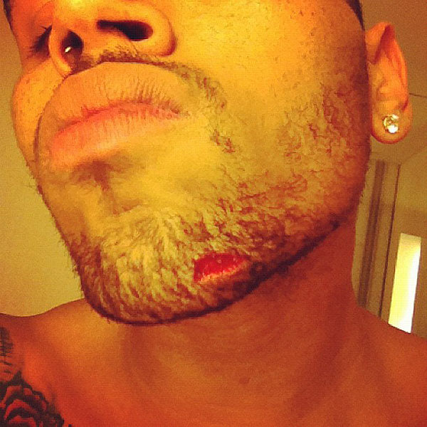 Drake Attacks Chris Brown In NYC  Bloody Photo Posted On Twitter