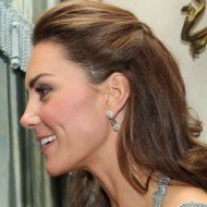 Sotto i capelli, all’altezza della tempia sinistra, si intravede una grande cicatrice. Fonti di palazzo hanno confermato che Kate Middleton ha subito un importante intervento chirurgico quando era una bambina.