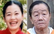 El insólito caso de la joven que envejeció 50 años en unos días Nguyenthi_2026486c