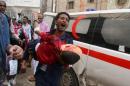 Man shouts as he carries a boy injured by a shell that landed in a residential area during fighting between Houthi militants and pro-government militants in Yemen's southwestern city of Taiz