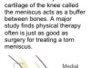 Graphic locates cartilage meniscus in the knee