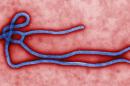 This colorized transmission electron micrograph (TEM) obtained March 24, 2014 from the Centers for Disease Control (CDC) in Atlanta, Georgia, reveals some of the ultrastructural morphology displayed by an Ebola virus virion