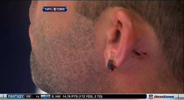 matt-schaub-ear.jpg