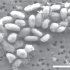 'Arsenic Life' Debate Reveals Challenge of Alien Microbe Search