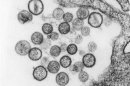 Undated handout shows the ultrastructural appearance of a number of virus particles, or 