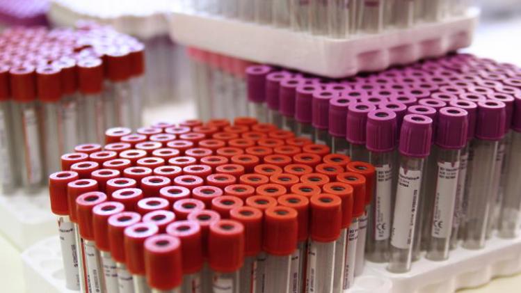Racks of vacuum venipuncture test tubes filled with blood are pictured on July 6, 2012