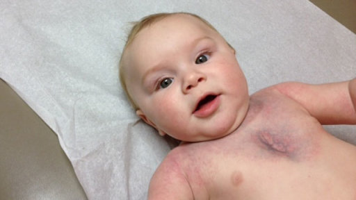 Family of Rare Disease Baby 'Grateful'