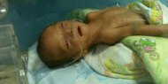 Dera, bayi yang sakit pernapasan ditolak 5 RS di Jakarta
