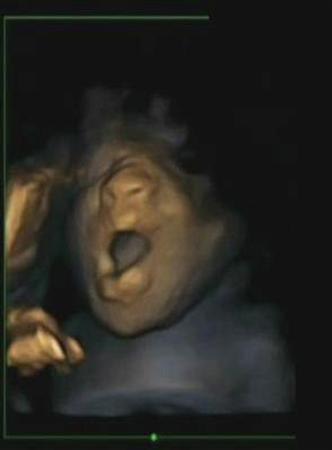 A 4D ultrasound scan shows a foetus yawning in the womb during a study by Durham and Lancaster Universities and released in Durham, northern England