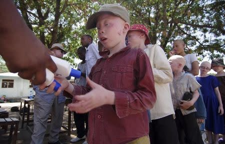 Albino children queue to receive sunscreen in Nyawilimilwa