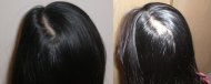 وصفات طبيعية للتخلص من فراغات الشعر 20140105113530