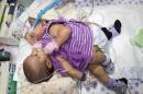 Handout photo of conjoined twins Knatalye Hope Mata and Adeline Faith Mata with at Texas Children's Hospital in Houston