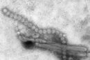 This Monday, April 15, 2013 electron microscope image provided by the Centers for Disease Control and Prevention shows the H7N9 virus which can take on a variety of shapes. Almost three weeks after China reported finding a new strain of bird flu in humans, experts are still stumped by how people are becoming infected when many appear to have had no recent contact with live fowl and the virus isn't supposed to pass from person to person. Understanding how the H7N9 bird flu virus is spreading is a goal of international and Chinese experts assembled by the World Health Organization as they begin a weeklong investigation Friday, April 18, 2013. (AP Photo/CDC, C.S. Goldsmith, T. Rowe)