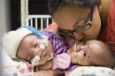 Handout photo of conjoined twins Knatalye Hope Mata and Adeline Faith Mata with their mother Elysse Mata at Texas Children’s Hospital in Houston