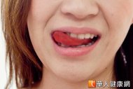 舌頭發紅，小心是身體出現警訊。醫師表示，舌頭味蕾發紅或是舌苔底發白，大多是病毒所造成。