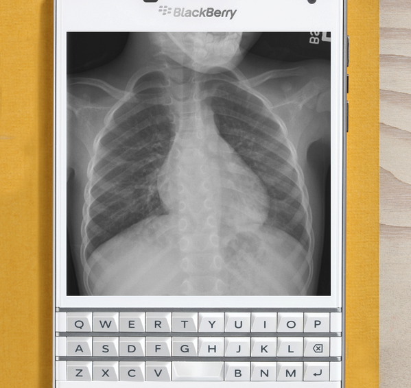 BlackBerry reveals the Passport’s killer feature: The ability to look at x-rays of your lung