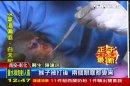 母猴遭毒打昏迷　人醫救猴送斷層掃描