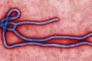 This photo provided by the CDC shows an ebola Virus. U.S. health officials are monitoring the Ebola outbreak in Africa but say the risk of the deadly germ spreading to the United States is remote. (AP Photo/CDC)