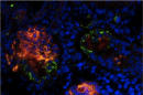 Induced Pluripotent Stem (iPS) cells have the potential to develop into any cell in the body