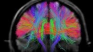 العلماء يكتشفون شبكة معقدة من الوصلات بالدماغ البشري 130217102949_human_brain_mapping_304x171_hcp_nocredit