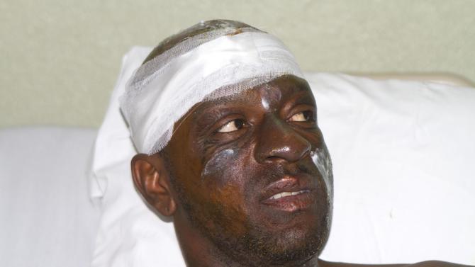 Singer Daniel Darinus, whose stage name is &quot;Fantom,&quot; from the Barikad Crew music group, talks with journalists from his hospital bed in Port-au-Prince, Haiti, Wednesday, Feb. 18, 2015. Daniel is recovering after being shocked by high-voltage wires during Tuesday&#39;s Carnival parade. (AP Photo/Dieu Nalio Chery)