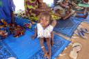 An infant suffering from malnutrition waits for treatment at a Doctors Without Boarders outpost in Guidan-Roumdji, Niger