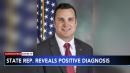 Pa. state rep reveals positive COVID-19 diagnosis, lawmakers outraged over alleged  lack of notification        