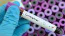 12th U.S. coronavirus case confirmed