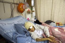 Palestinian boy shot by Israeli police loses sight in eye