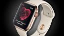 Should People Worried About Heart Conditions Buy the New Apple Watch?