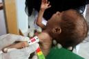World hunger worsening as coronavirus weighs and obesity rises: UN