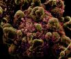 What the coronavirus does to your body that makes it so deadly