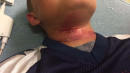 Biracial Boy Pushed Off Table With Rope Around His Neck: Family