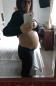 Woman Discovers Her 'Baby Bump' Is Massive Ovarian Tumors