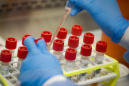 US virus testing faces new headwind: Lab supply shortages