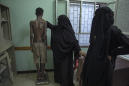 Migrants endure rape and torture on route through Yemen