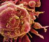 Plasma from recovered coronavirus patients boosts others' survival rate, study says