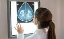 Breast cancer drug gives new hope to young women with disease by improving survival by 50 per cent